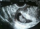 Fotografia plodu, ultrazvuk, fotografia brucha ženy a video
