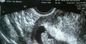 ภาพถ่ายของทารกในครรภ์ อัลตราซาวนด์ ภาพถ่ายหน้าท้องของผู้หญิง และวิดีโอ